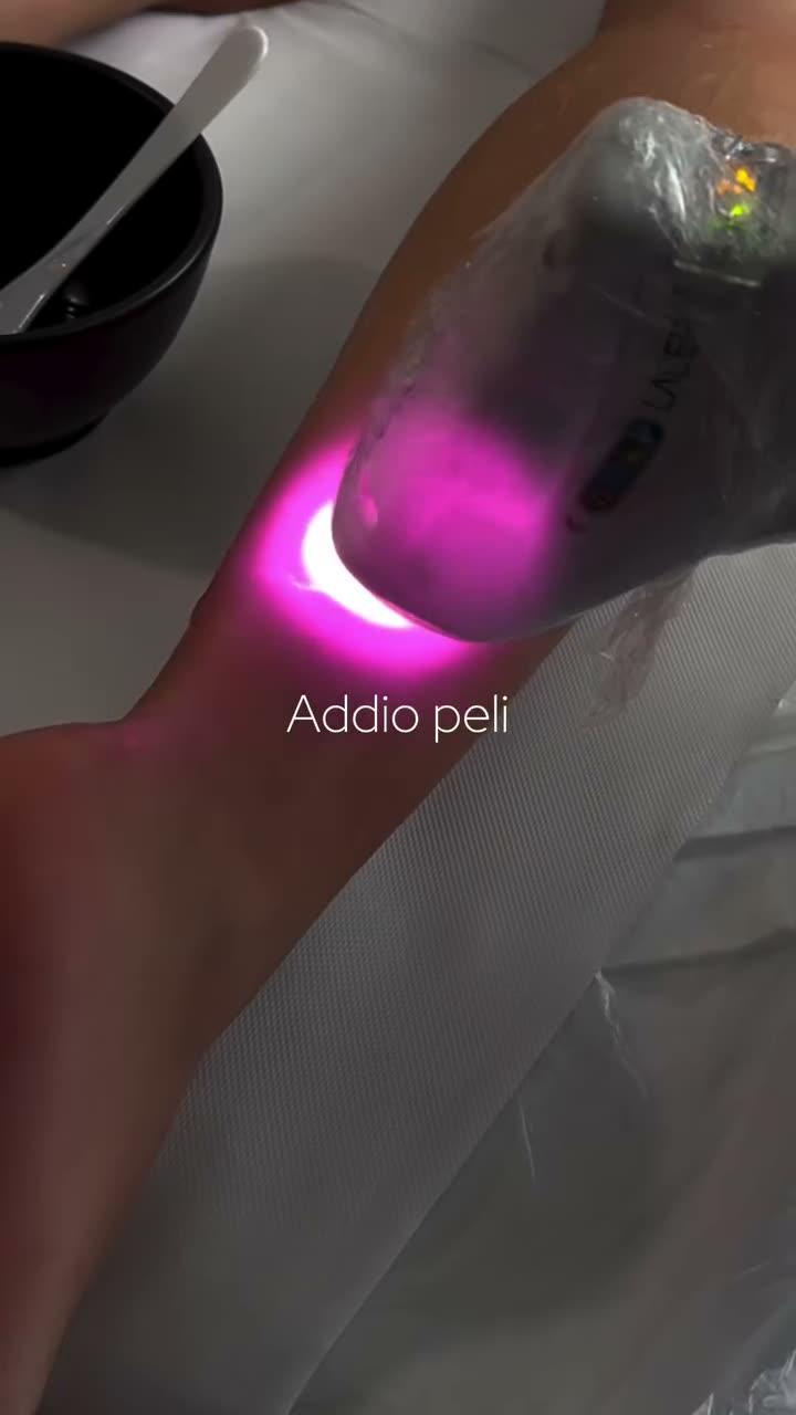 Seduta di depilazione laser sulla gamba